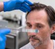 Hair Restoration Las Vegas