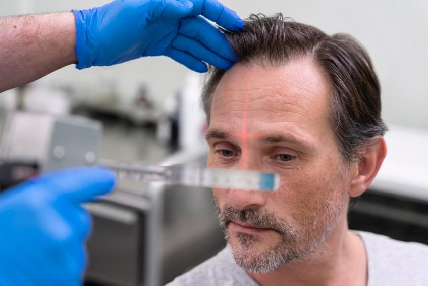 Hair Restoration Las Vegas