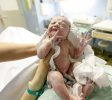 Pregnancy-Childbirth